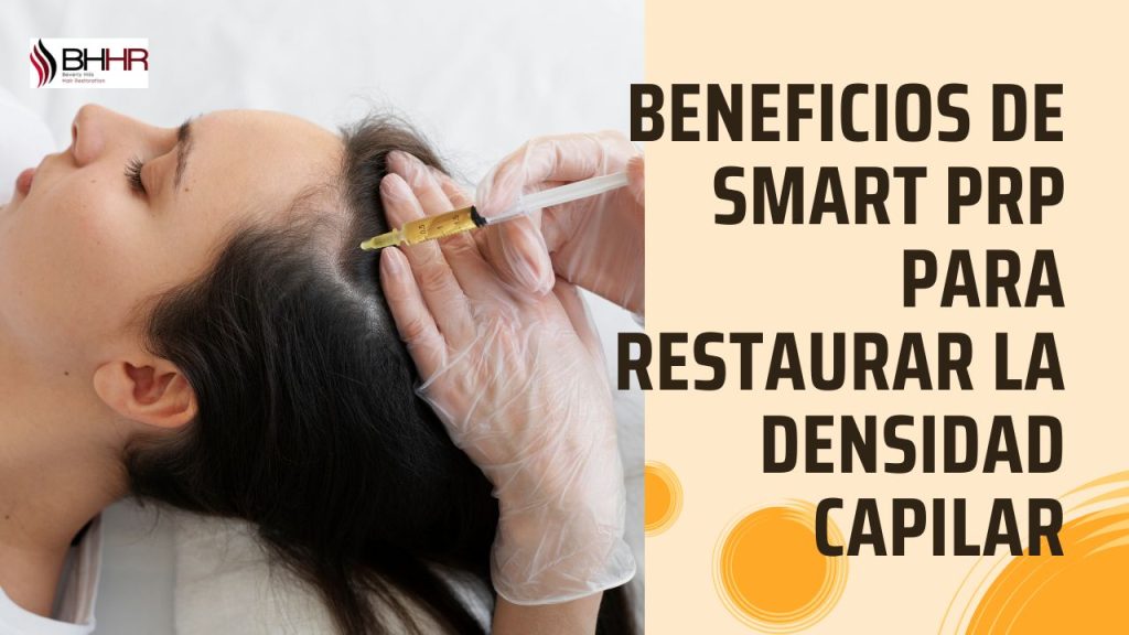 Beneficios de Smart PRP para Restaurar la Densidad Capilar
