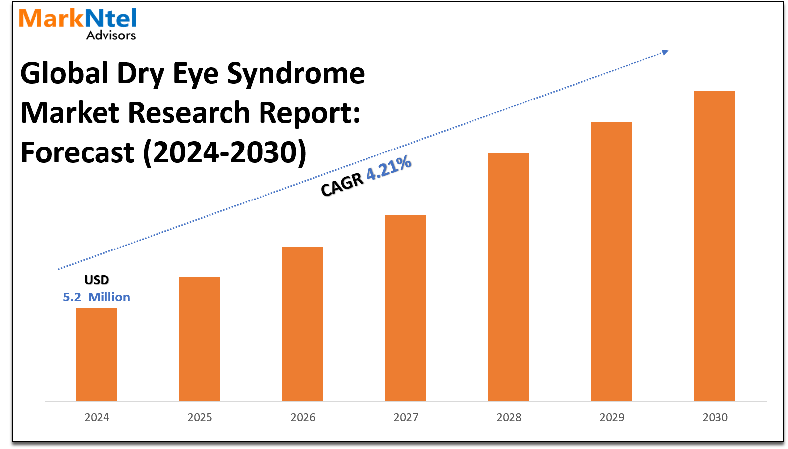 Dry Eye Syndrome Market