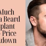 How Much Does a Beard Transplant Cost – Price Breakdown