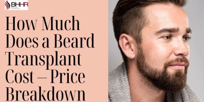 How Much Does a Beard Transplant Cost – Price Breakdown