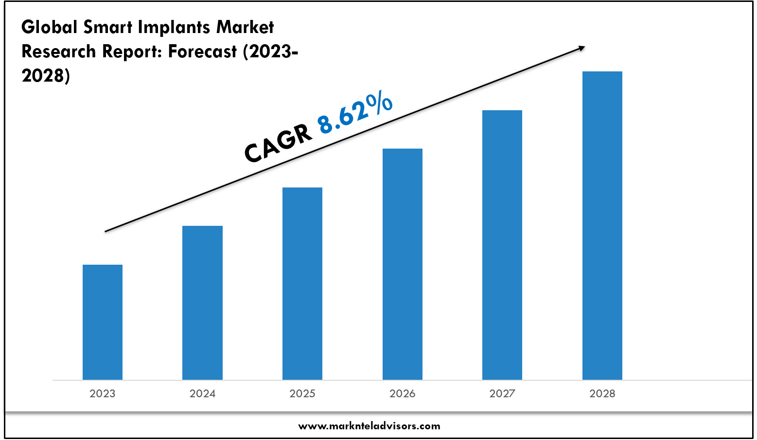 Smart Implants Market