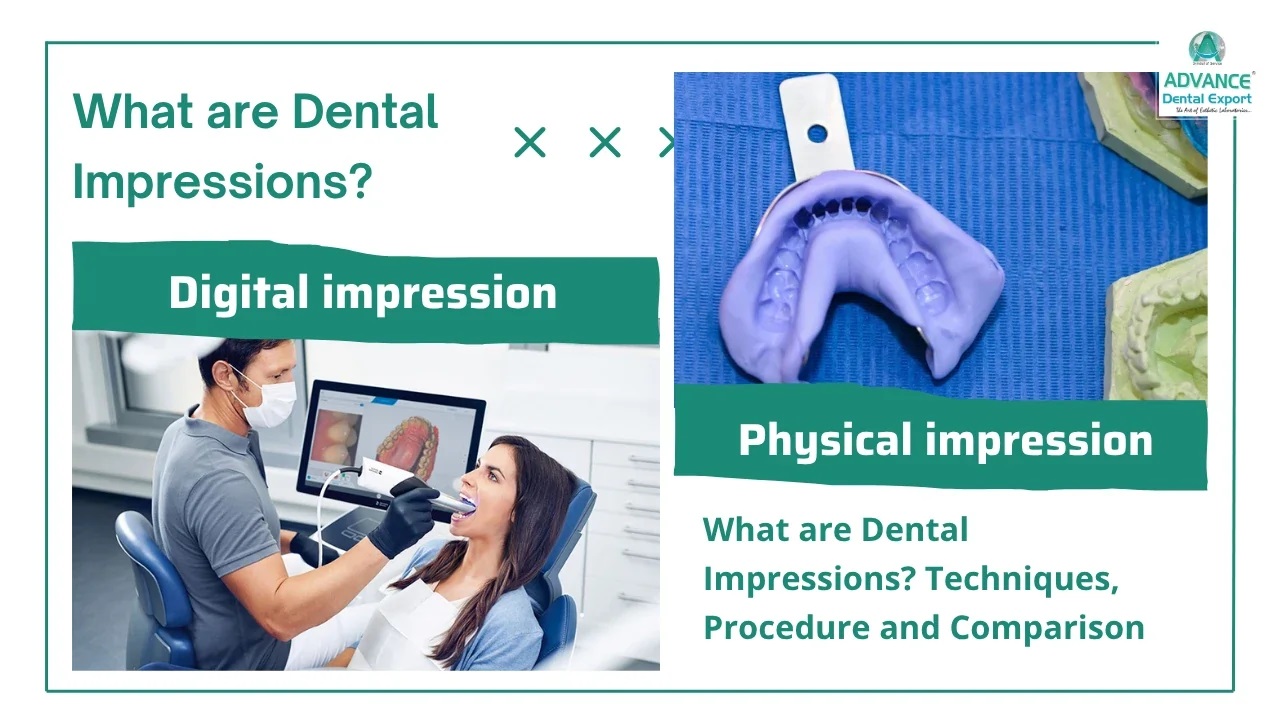 What_are_Dental_Impressions_Techniques_Procedure_and_Comparison_1280_x_720