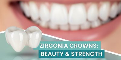 Zirconia Crown A Modern Dental Solution for Your Smile