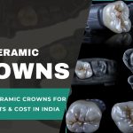 All About Ceramic Crowns for Teeth Benefits & Cost in India