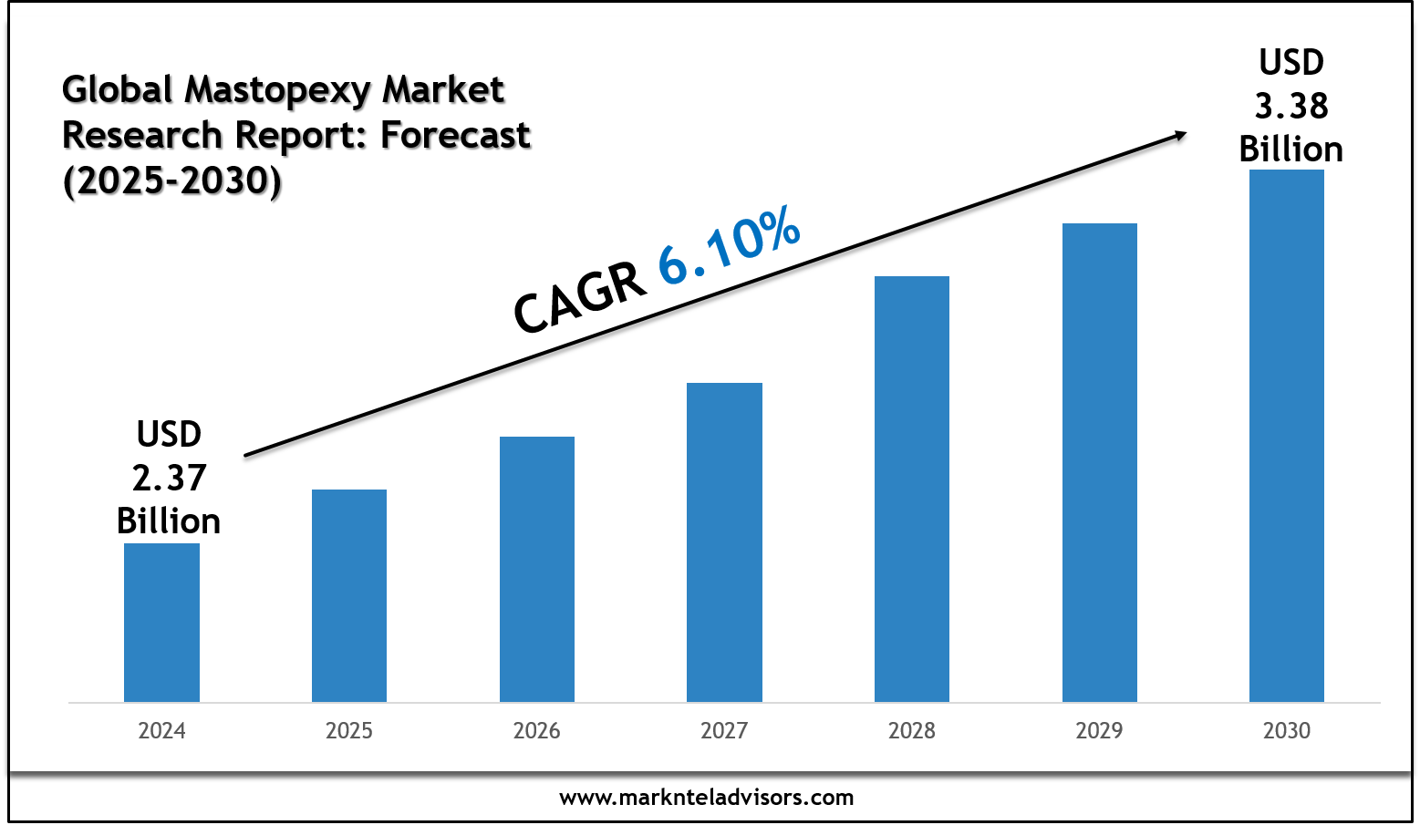 Future of Global Mastopexy Market: Size, Growth & Key Players like Cynosure, GC Aesthetics