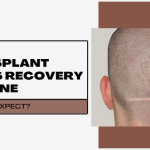 Hair Transplant Scars