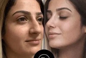 Discover the Best Doctors in Dubai for Every Treatment