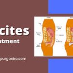 What Are the Latest Techniques Used for Ascites Treatment in Jaipur?